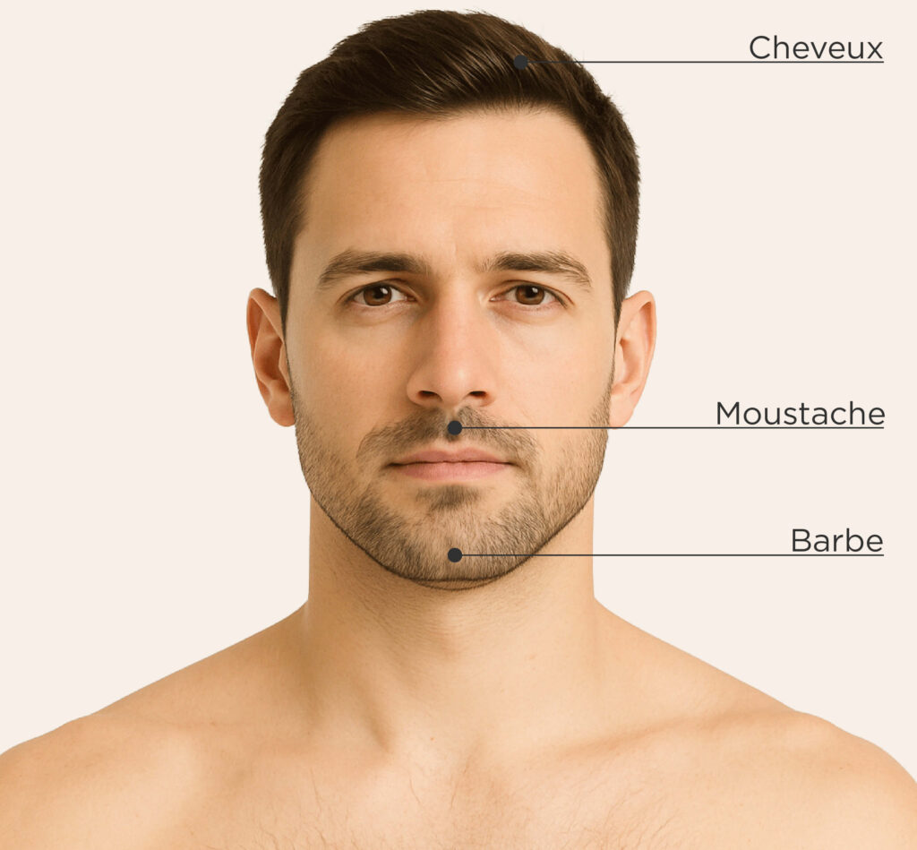 Zones traitables chez l’homme pour le traitement de l’alopécie : cheveux, moustache, barbe.