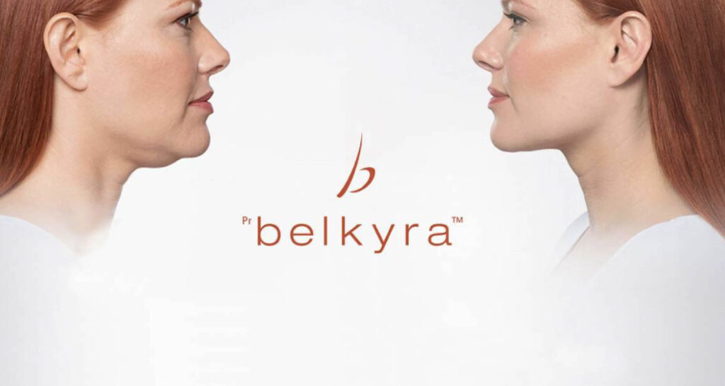 Résultat avant/après du traitement Belkyra™ pour la réduction du double menton chez une femme rousse, profil gauche et droit, avec logo Belkyra au centre.