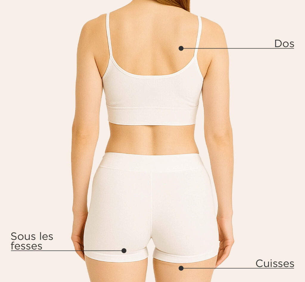 Zones traitables pour le traitement CoolSculpting Elite chez la femme : dos, sous les fesses, cuisses
