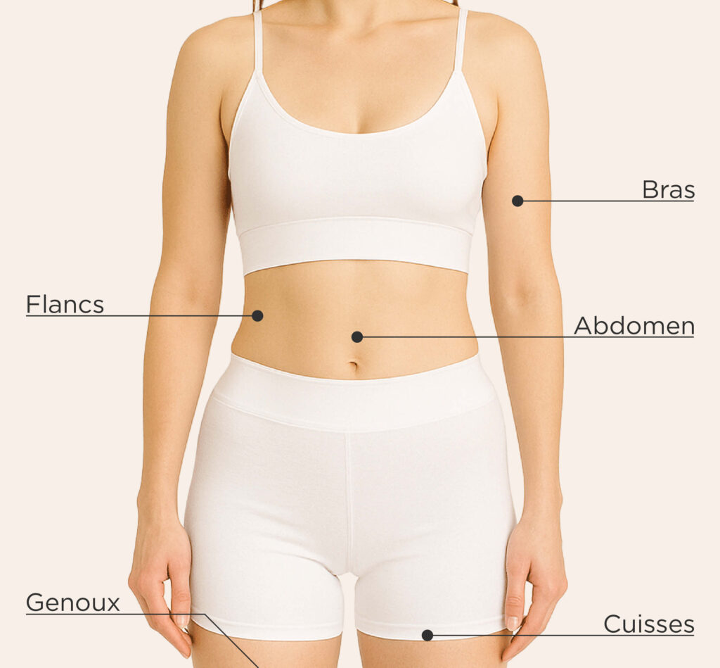 Zones traitables pour le traitement CoolSculpting Elite chez la femme : bras, abdomen, flancs, genoux, cuisses