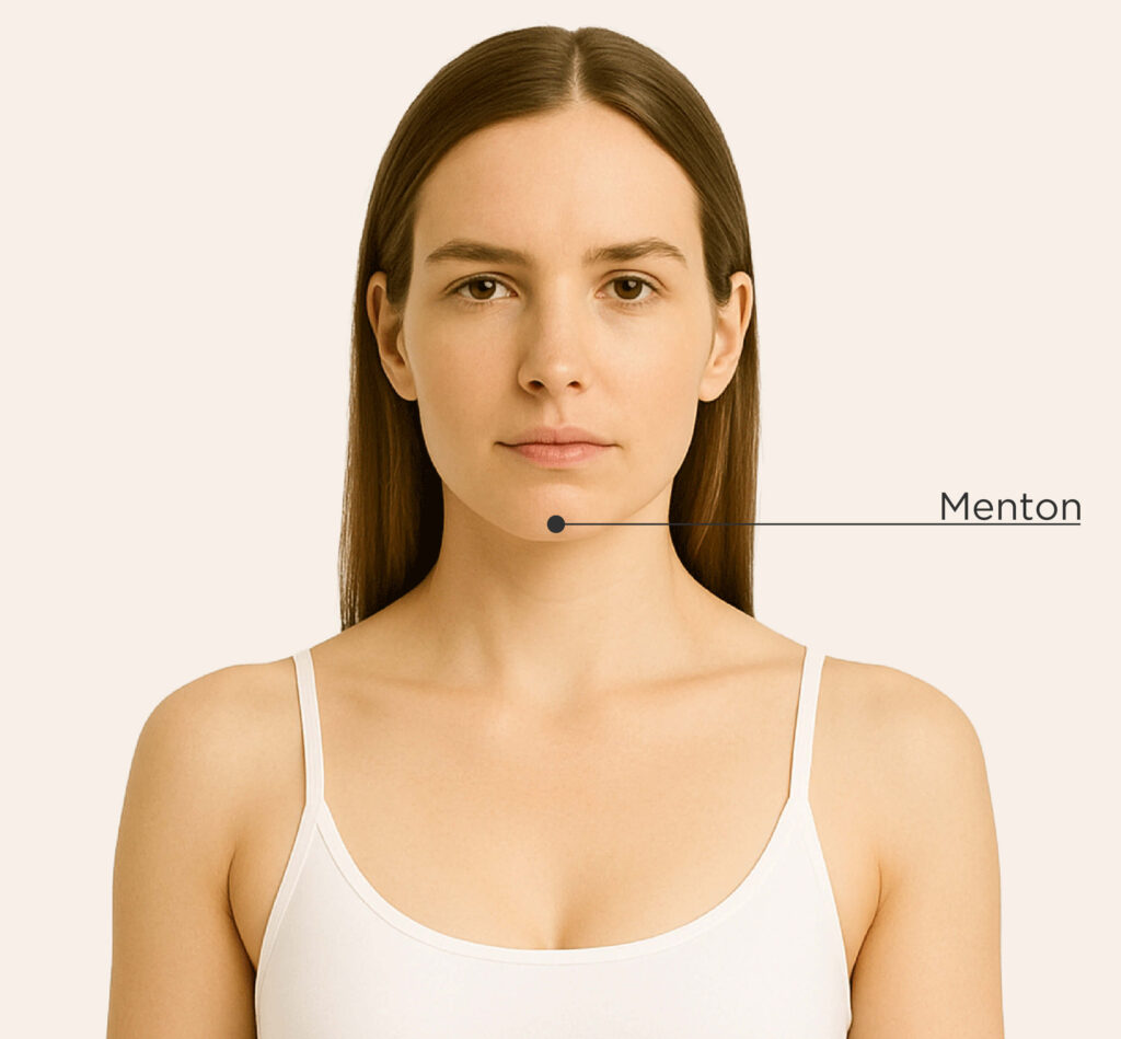Zone traitable pour le traitement CoolSculpting Elite chez la femme : menton