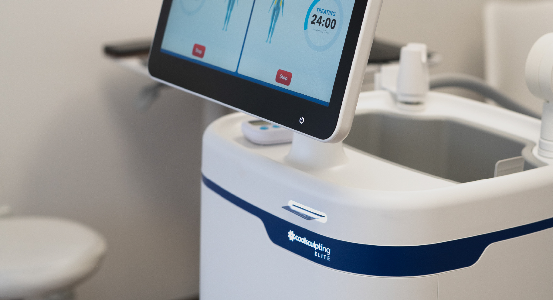 Appareil CoolSculpting Elite affichant l’interface de traitement de cryolipolyse en cours