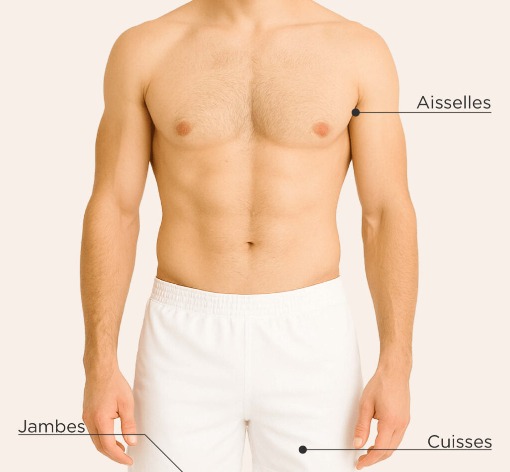 Zones traitées pour l’hyperhidrose chez l’homme : aisselles, jambes et cuisses.