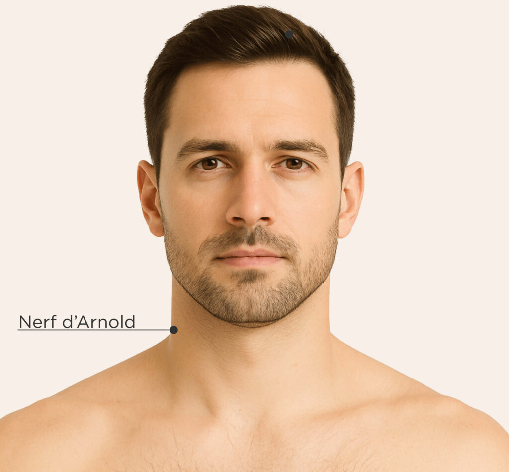 Image représentant les zones traitables chez l’homme pour le traitement du nerf d’Arnold.