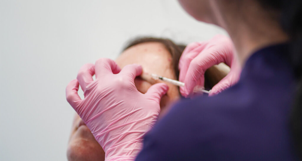 Injection esthétique au niveau du front réalisée par une professionnelle portant des gants roses en clinique médico-esthétique
