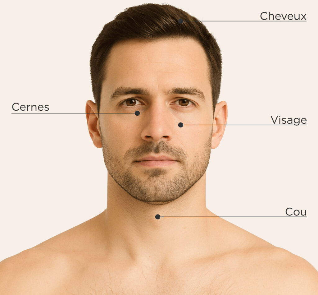 Zones traitables pour le traitement PRP chez l’homme : Cheveux, cernes, visage, cou.