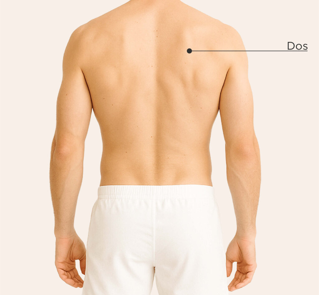 Zones traitables pour le traitement Peeling ZO Skin chez l’homme : dos.