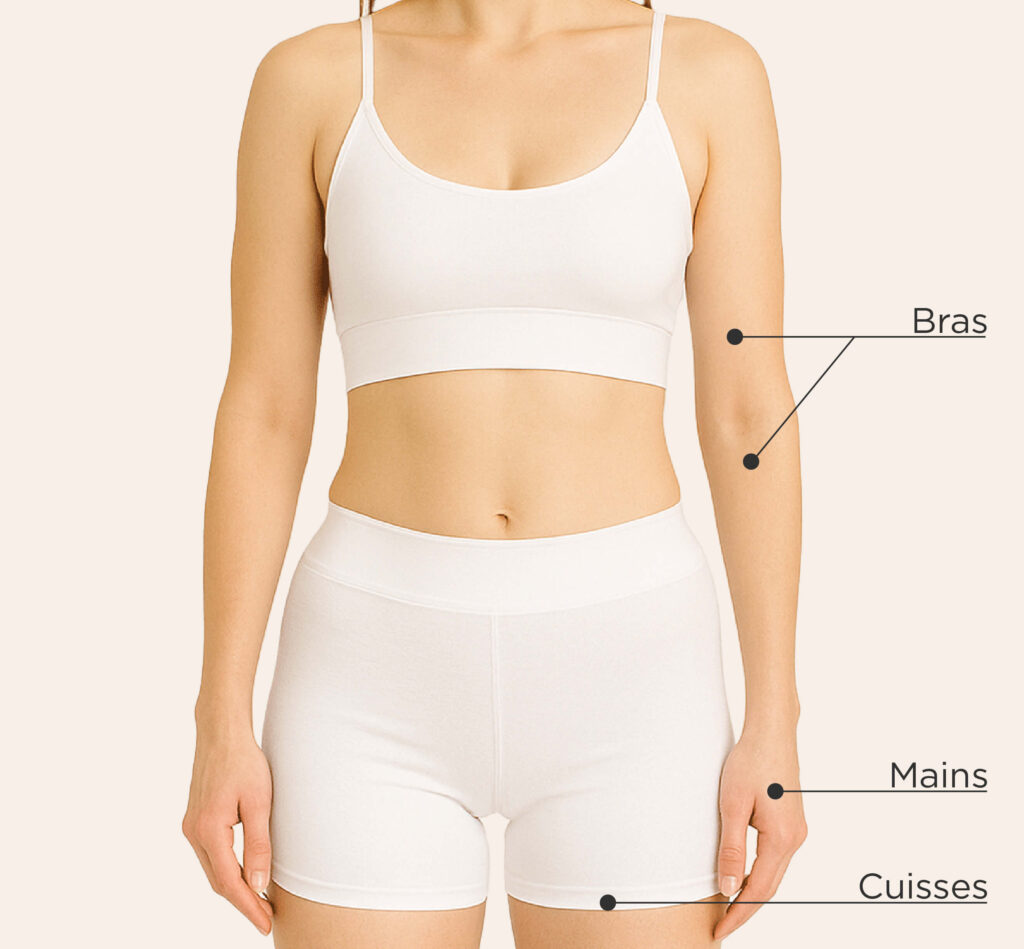 Zones traitables avec Sculptra sur le corps féminin : bras, mains et cuisses (vue avant).