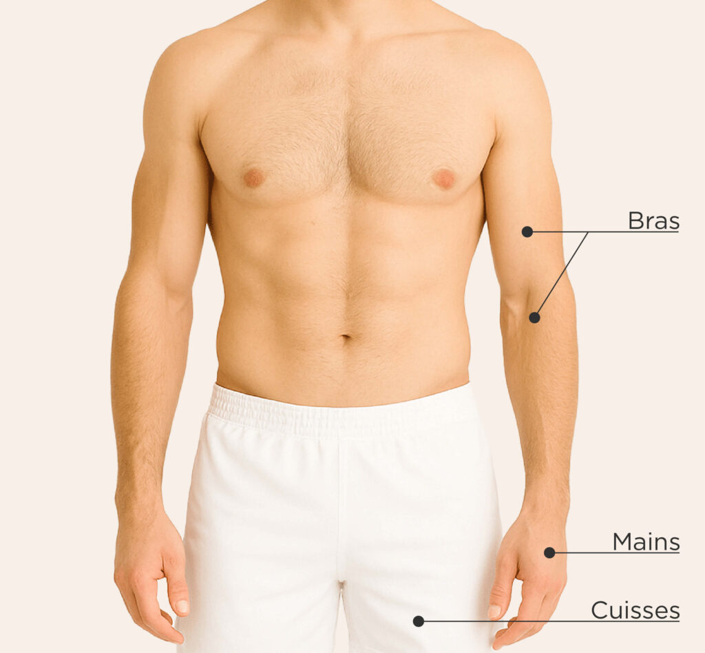 Zones traitables avec Sculptra chez l’homme : bras, mains et cuisses.