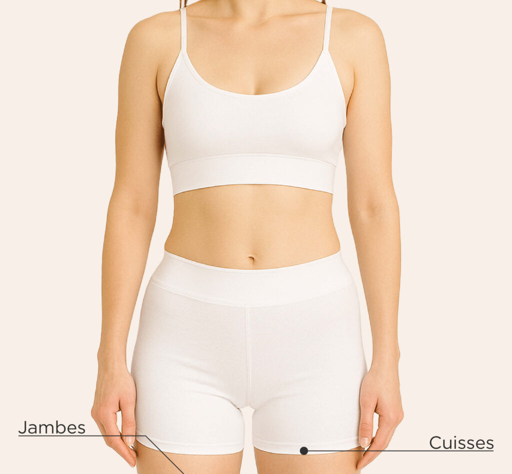 Zones traitables chez la femme pour le traitement par sclérothérapie : jambes, cuisses.